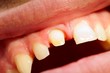 Dentist 's work