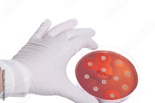 Photo: Hand in clove with petri dish Hand in clove with petri dish