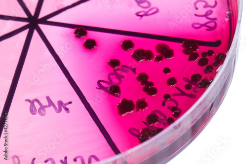 Photo: Bacteria on petri dish Bacteria on petri dish
