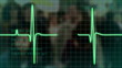Video: electrocardiogram pulse trace electrocardiogram pulse trace
