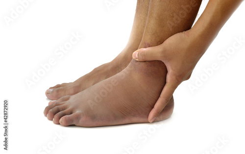 Photo: ankle sprain ankle sprain