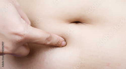 Photo: Stomach fat woman body part. Stomach fat woman body part.