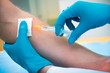 Injection