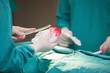 Surgeon doing an operation while holding surgical tissue