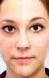 Beauty face - before and after
