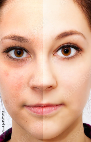 Foto: Beauty face - before and after Beauty face - before and after