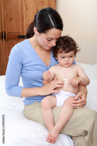 Photo: Mum applying cream to baby's rash Mum applying cream to baby's rash