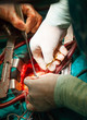 Surgery. Image with shallow DOF.