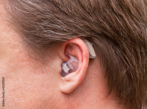 Photo: Close-up of a man ear with hearing aid Close-up of a man ear with hearing aid