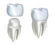 Dental crowns and tooth, isolated on white