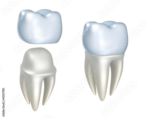 Illustration: Dental crowns and tooth, isolated on white Dental crowns and tooth, isolated on white