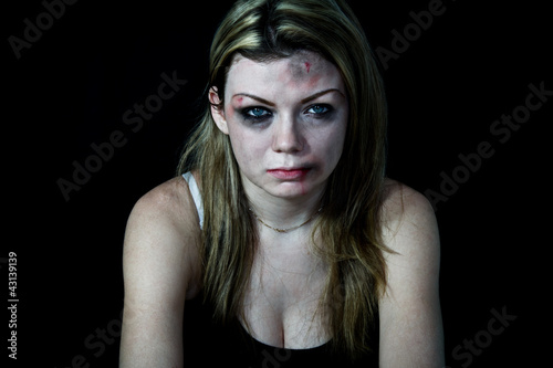 Photo: Beaten Woman with bruises and blood Beaten Woman with bruises and blood