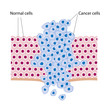 Cancer cells in a growing tumor, eps8