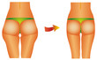 Diet beauty before after female buttocks