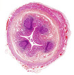 Microscope picture of human appendix
