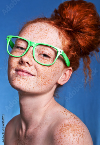 Foto: Girl covered with freckles Girl covered with freckles