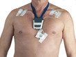 EKG