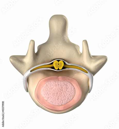 Illustration: Normal disc, spinal cord and nucleus pulposus - top view Normal disc, spinal cord and nucleus pulposus - top view