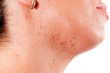 Skin problems