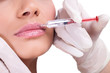 Foto: woman receiving a botox injection in her lips woman receiving a botox injection in her lips