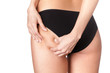 Cellulite skin, isolated, white background