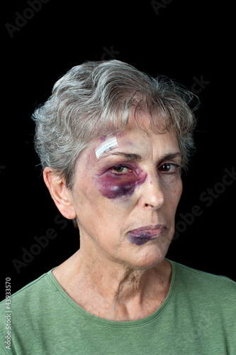 Photo: Beaten elderly woman Beaten elderly woman