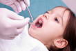 Photo: dental examination dental examination