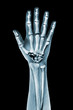 dramatized x ray of a hand on black