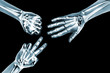 rock paper scissors game with x ray hands
