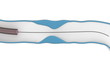Coronary Angioplasty procedure