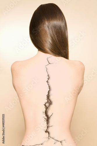 Photo: Bare back of woman with a crack on spine over colored background Bare back of woman with a crack on spine over colored background