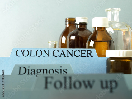 Photo: Colon cancer staging Colon cancer staging
