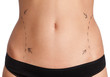 Liposuction, isolated, white background