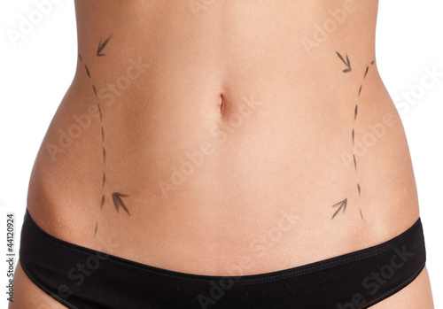 Liposuction, isolated, white background
