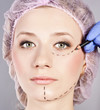 Photo: Cosmetic botox injection, in the female face. Cosmetic botox injection, in the female face.