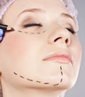 Cosmetic botox injection in the female face.