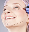 Photo: Cosmetic botox injection, in the female face Cosmetic botox injection, in the female face