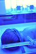 Newborn jaundice