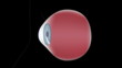 Lens clouding in cataract eye disease