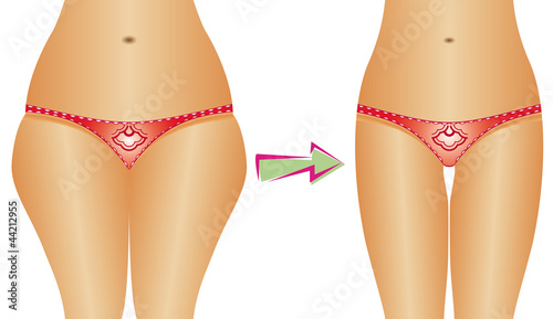 Vector: Diet, weight loss Diet, weight loss