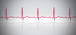 ECG background