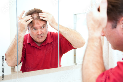 Photo: Thinning Hair in Middle Age Thinning Hair in Middle Age