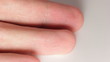 Disinfect finger