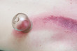 fire cupping treatment to cup sb therapy woman