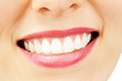 Photo: Smiling woman with great healthy white teeth Smiling woman with great healthy white teeth