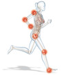 Arthrose Frau
