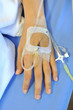 IV solution in a patients hand