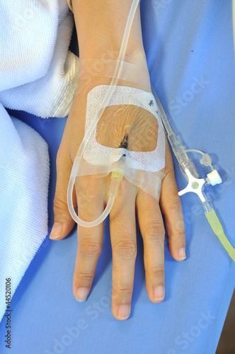 Photo: IV solution in a patients hand IV solution in a patients hand