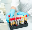 test tubes with blood