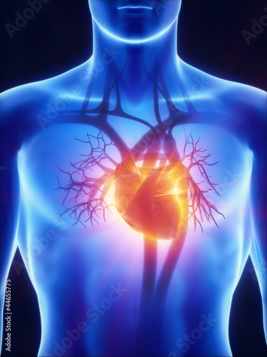Illustration: X-ray cardiovascular system X-ray cardiovascular system
